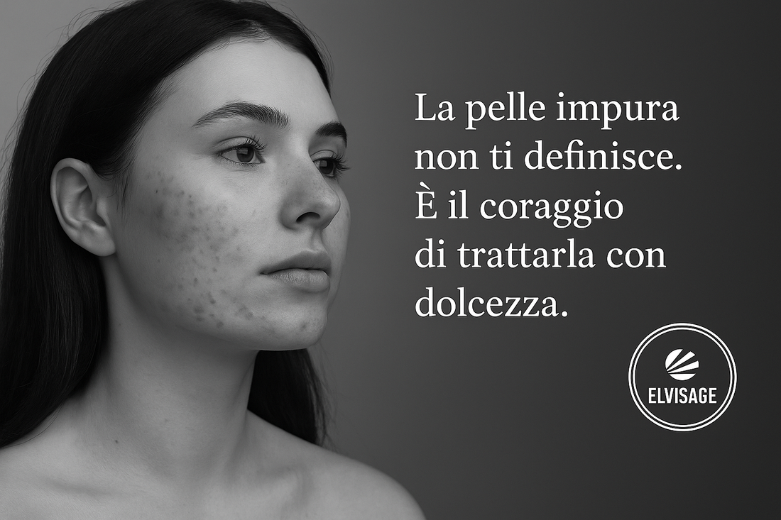 Trattare la Pelle Acneica | Prodotti Purificanti e Trattamenti Efficaci - Elvisage
