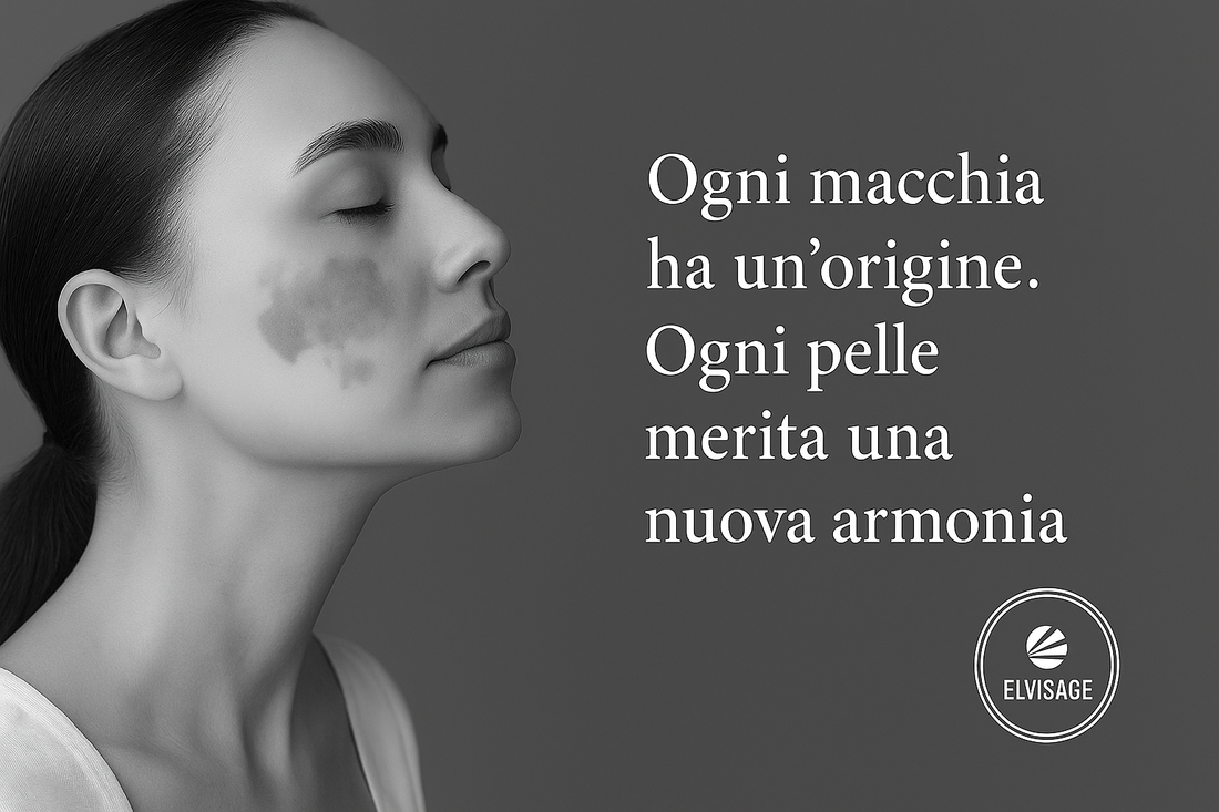 Trattare la Pelle Discromica | Schiarire le Macchie e Uniformare il Tono della Pelle - Elvisage